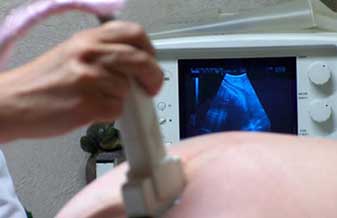 João Luiz Scaff - Foto 1